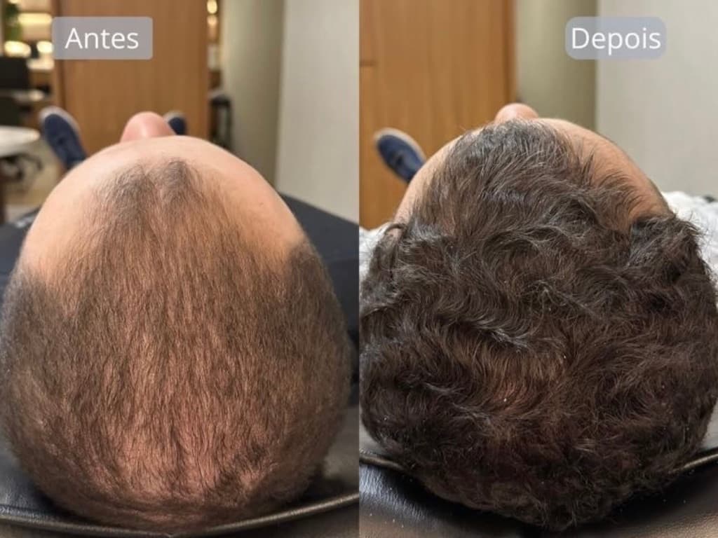 Resultado de tratamento capilar 4