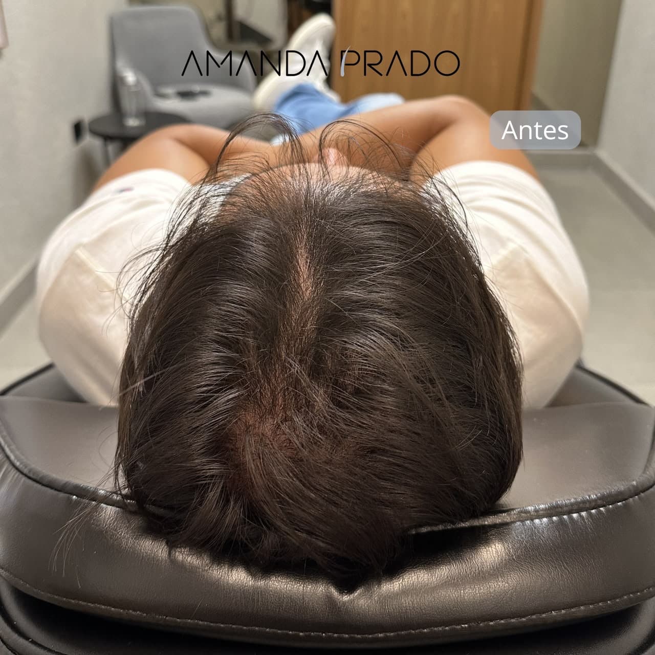 Antes