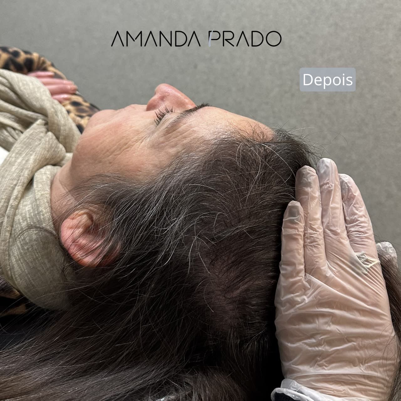 Depois