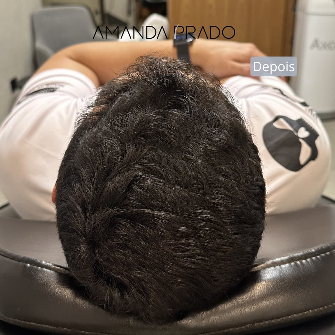 Depois